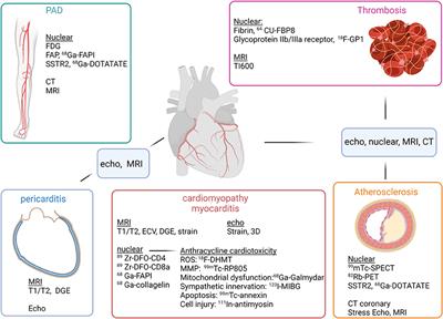 Multimodality Advanced Cardiovascular and Molecular Imaging for Early Detection and Monitoring of Cancer Therapy-Associated Cardiotoxicity and the Role of Artificial Intelligence and Big Data